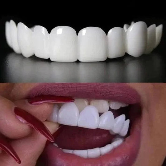 Carillas para DIENTES